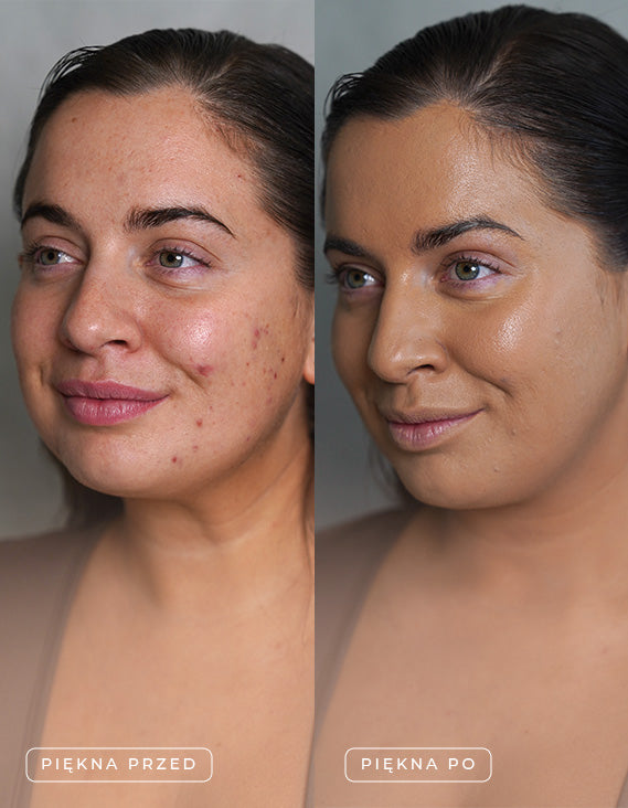 Set mit 4 Supreme Skin-Proben