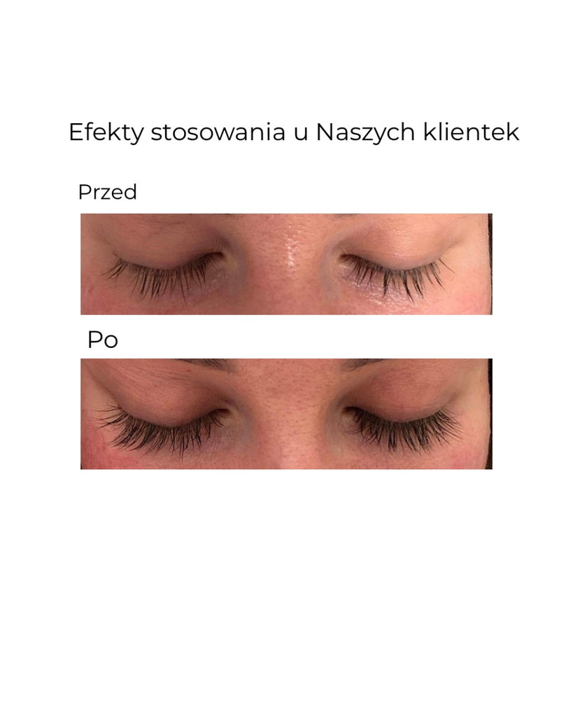 Éleverlash